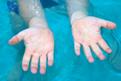  Why do your Fingers Wrinkle in water Osmosis?