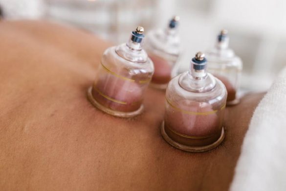 Cupping Therapy Massager
