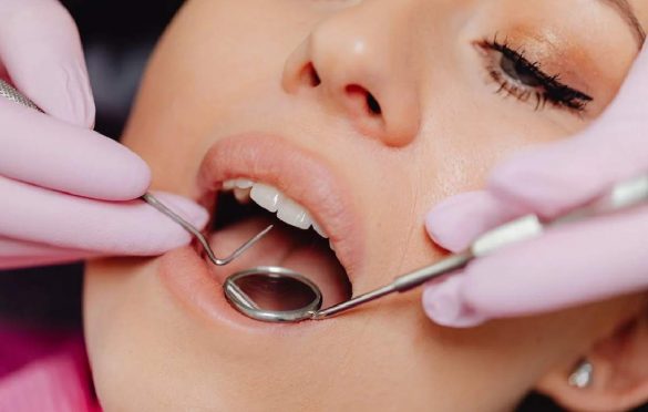  Understanding What Happens During A General Dental Cleaning