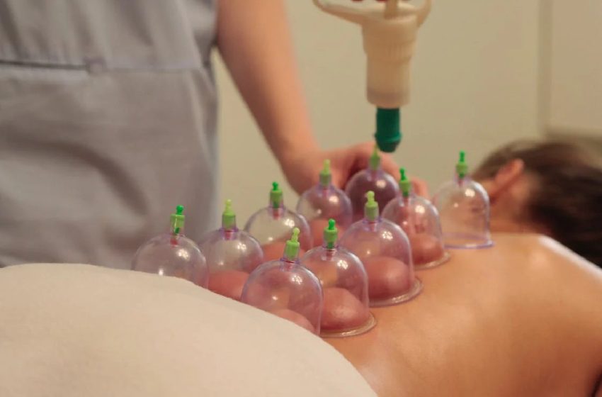 Here’s Why Cupping Massages Are Becoming So Popular