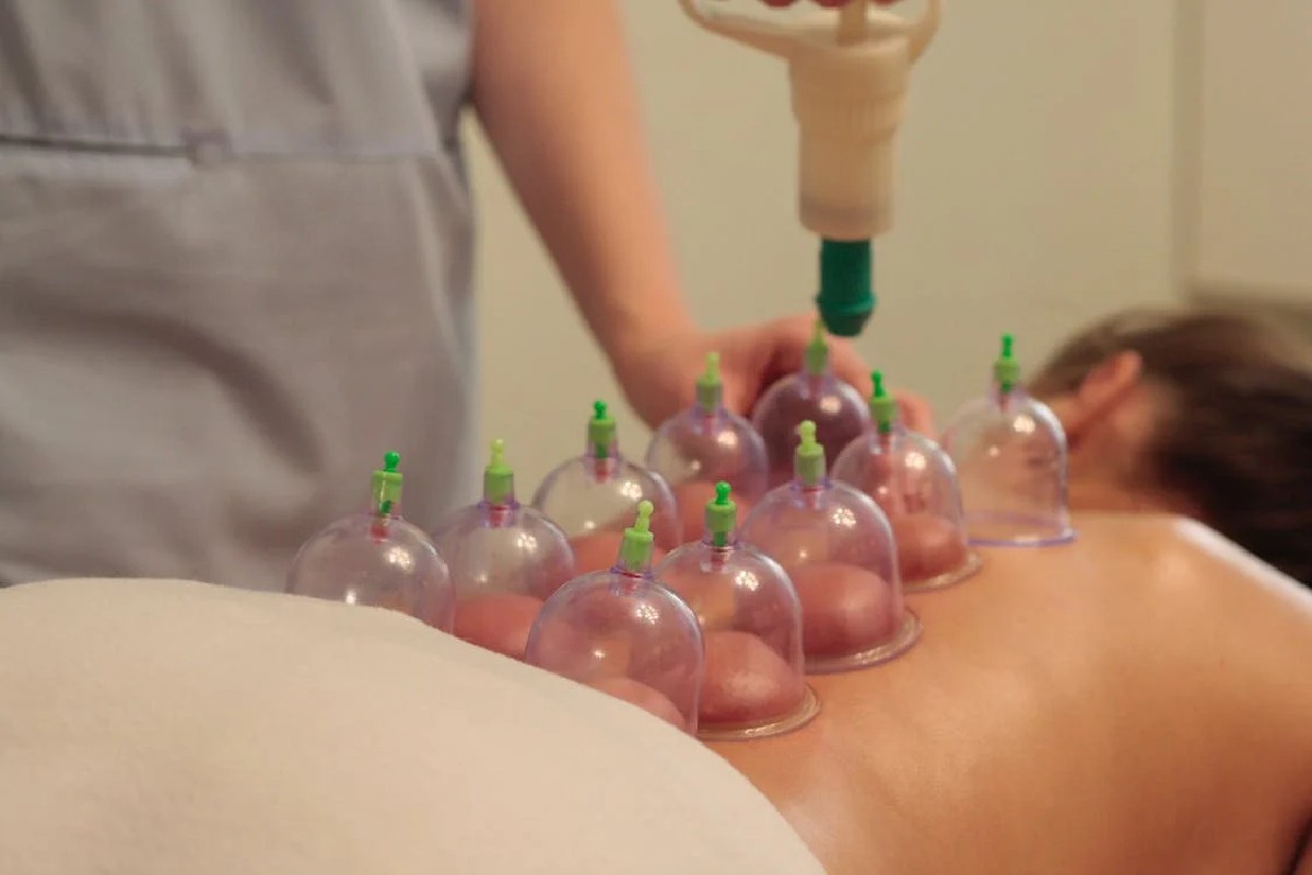 Here’s Why Cupping Massages Are Becoming So Popular